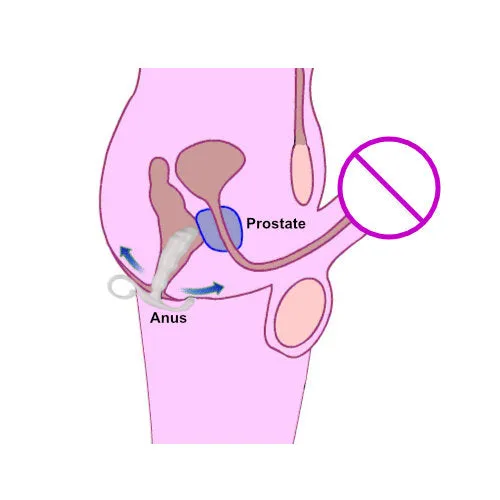 Javtoys Anal QY Prostate Stimulator Plug S
